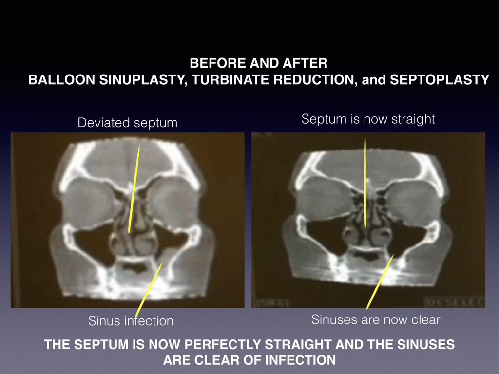 Sinus & Snoring Specialists Image