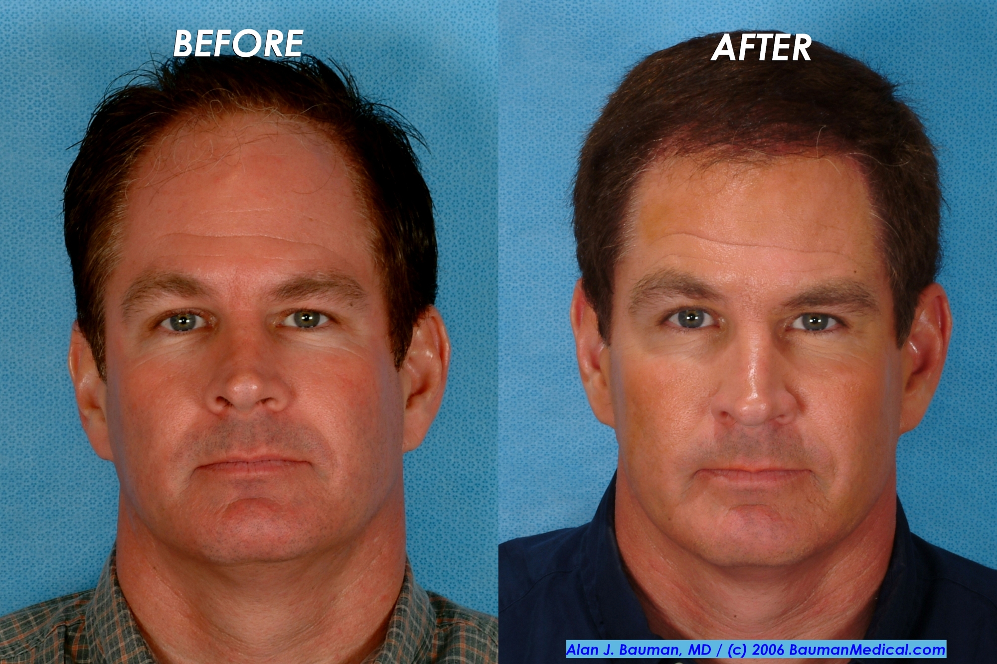 Dr. Alan J. Bauman - Bauman Medical Group Hair Transplant and Hair Loss Treatment Center Photo