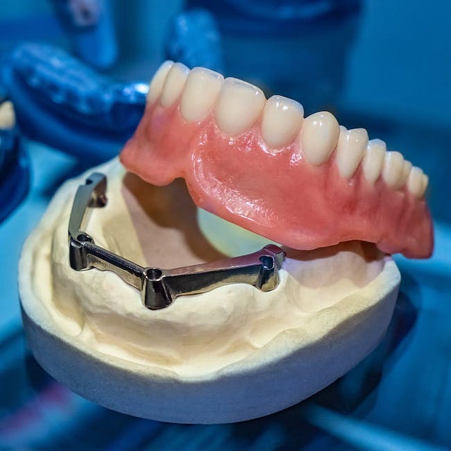 Implant-Supported Dentures
