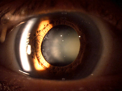 Images Centre d'Oftalmologia Romero