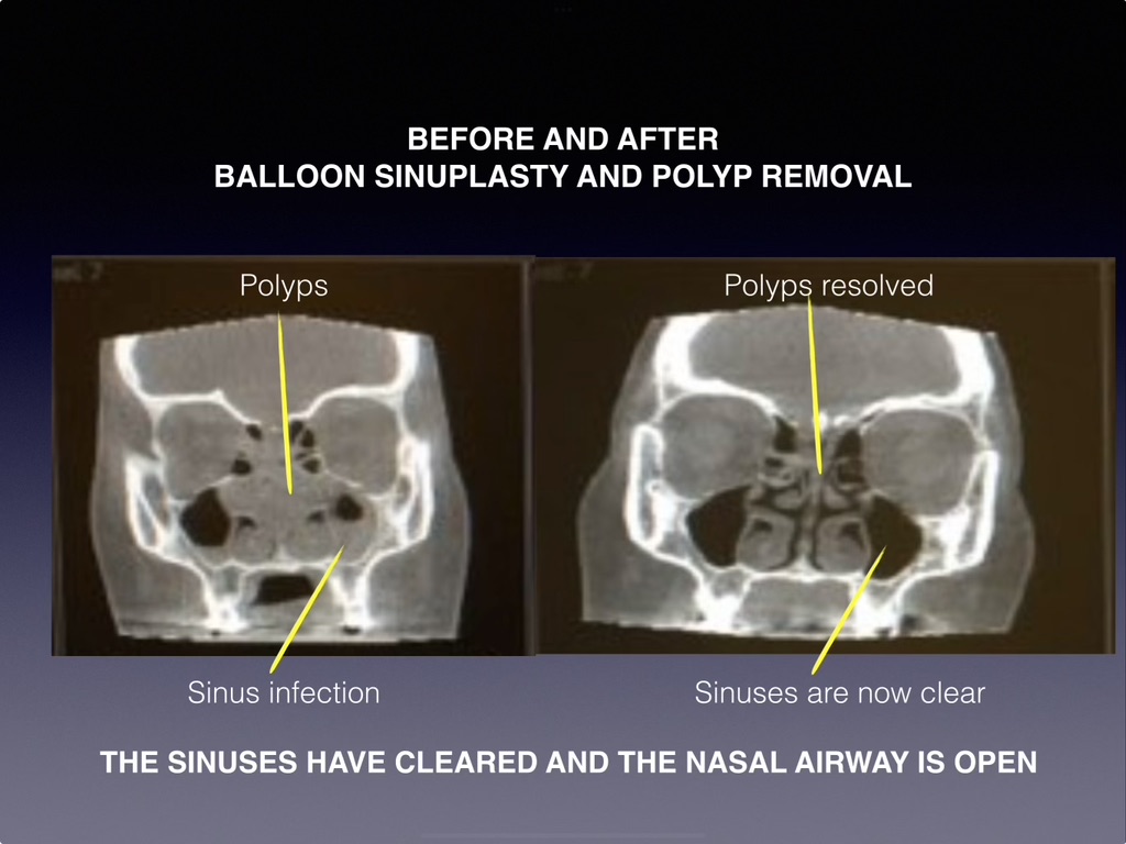 Sinus & Snoring Specialists Image