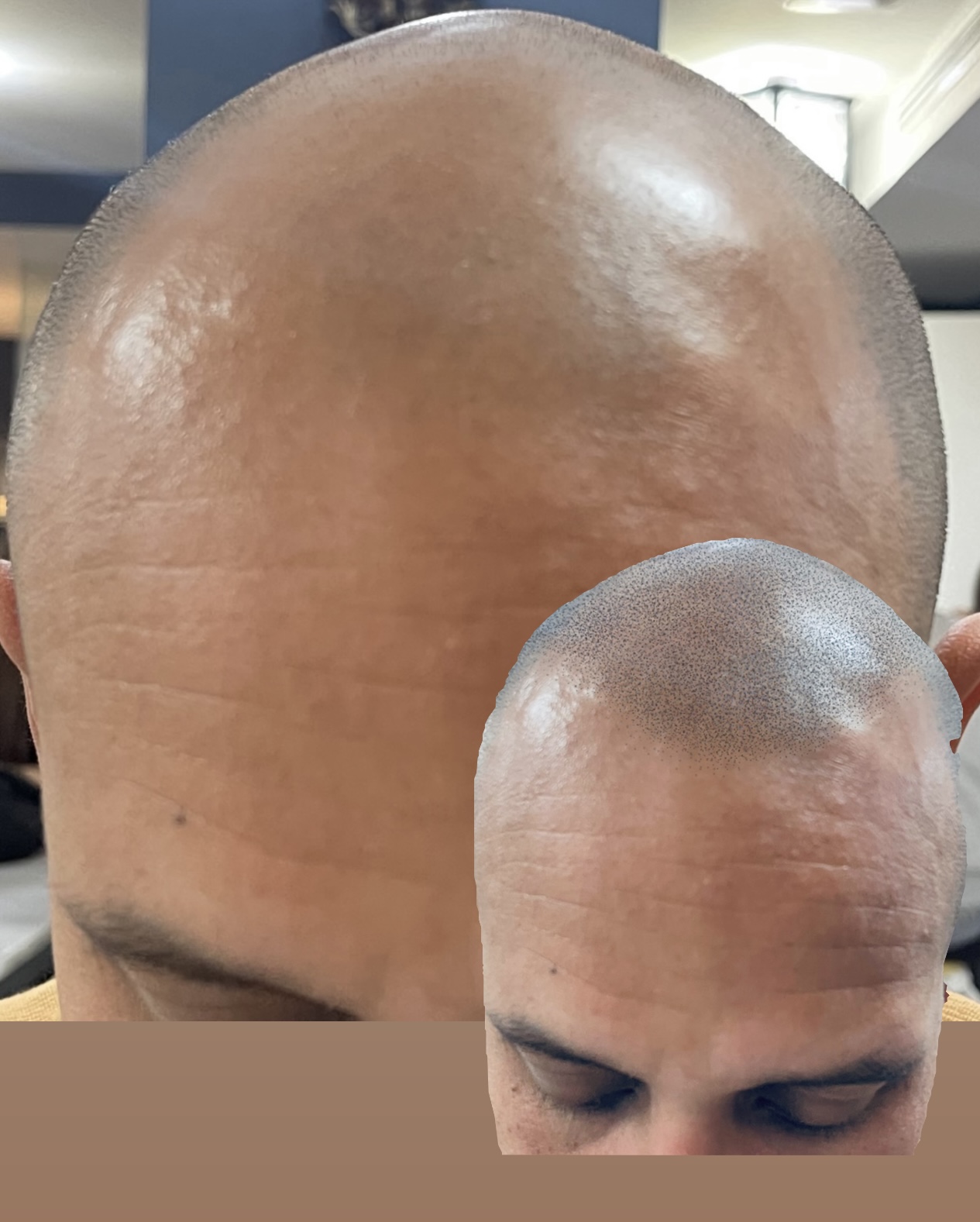 Galería en miniatura