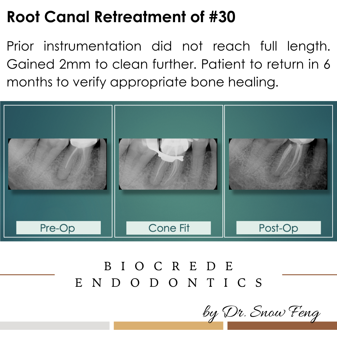 Biocrede Endodontics Image