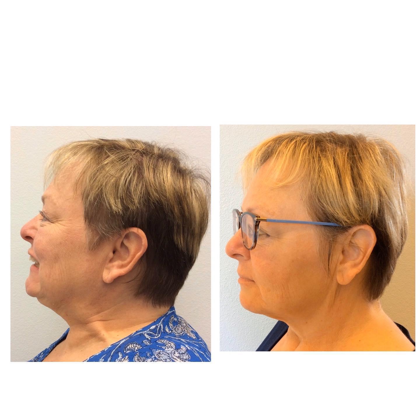 Lifetime Dental & Fastbraces Image