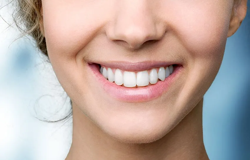 Porcelain Veneers