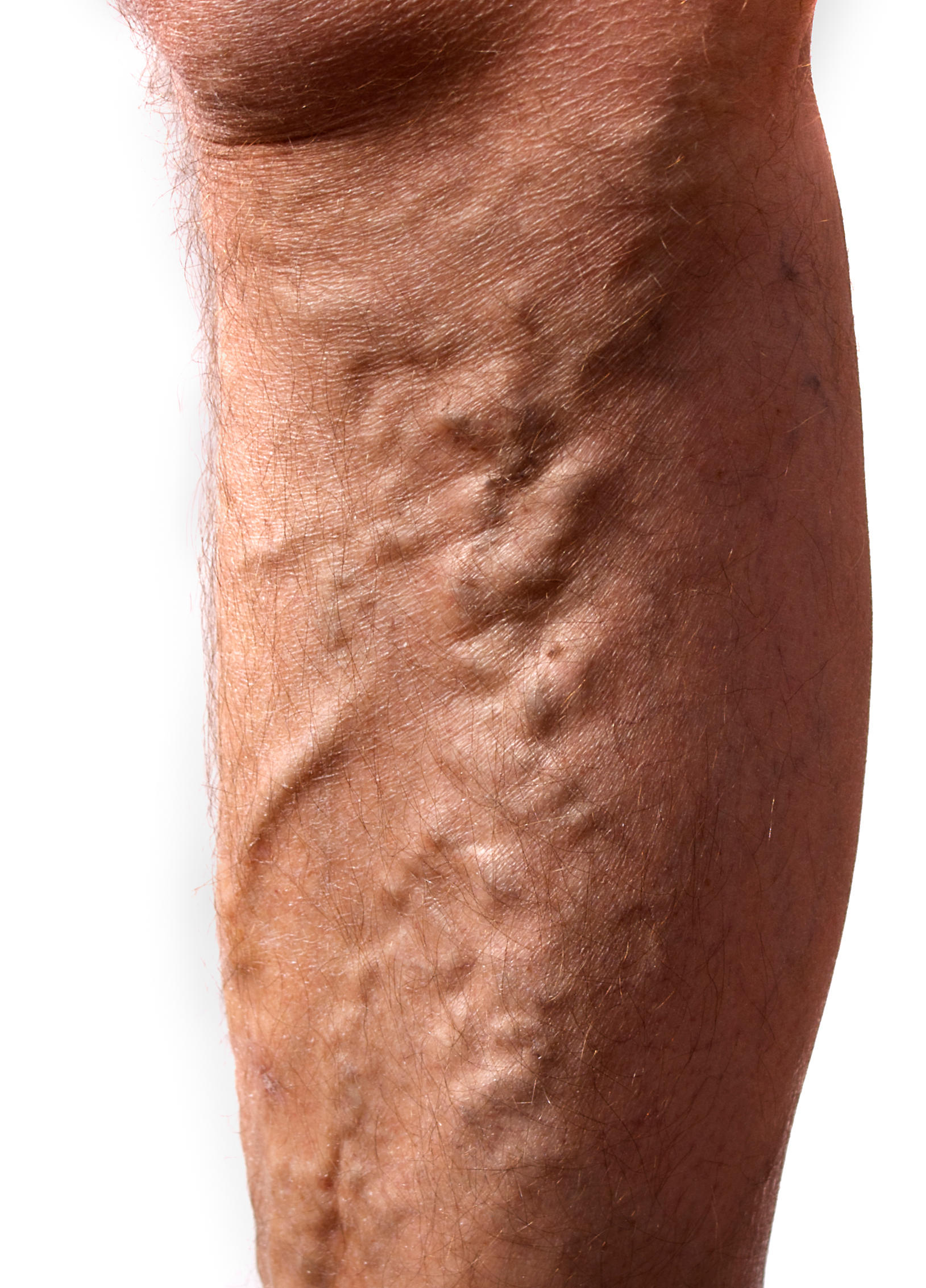 Providence Vein Center Photo