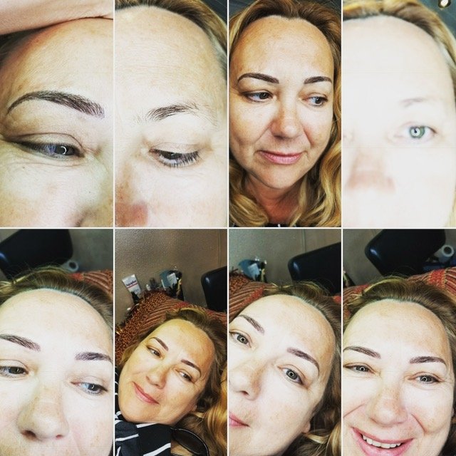 Images Brow Help