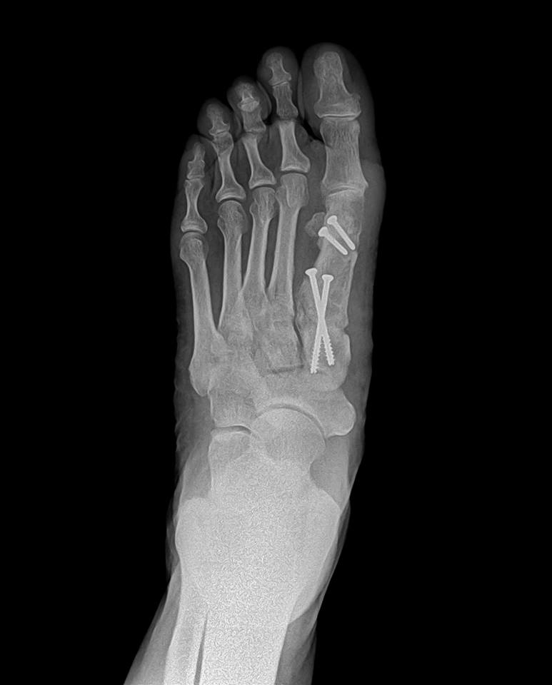 Elite Foot & Ankle Specialists Photo