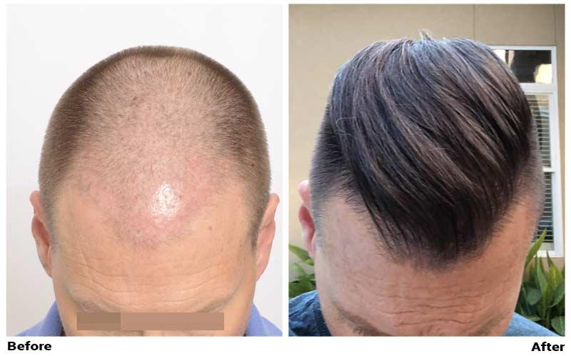 ForHair Hair Transplant Clinic Photo