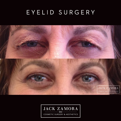 Jack Zamora MD Cosmetic Surgery and Aesthetics Photo