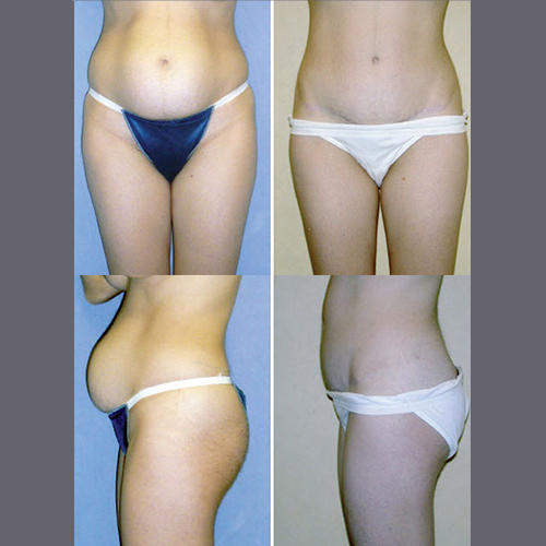 Images The Brandow Clinic Plastic Surgery - Kirk Brandow, MD