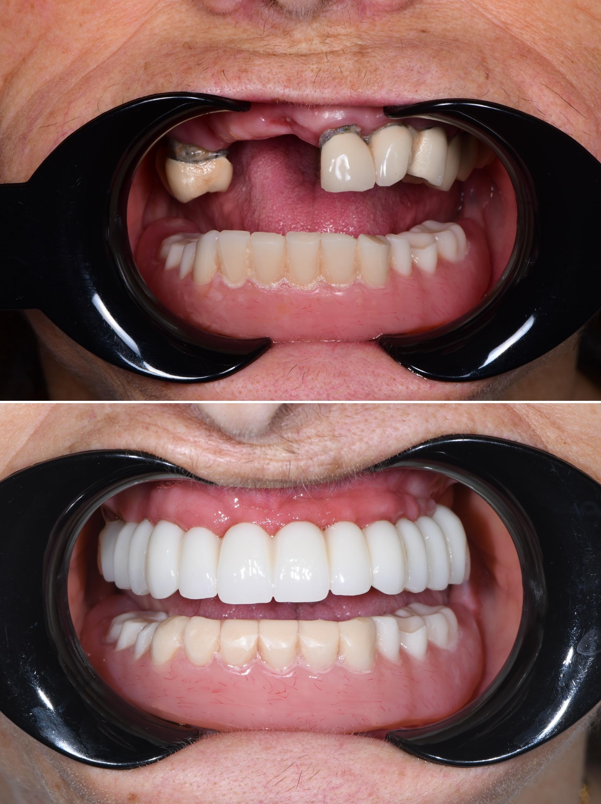 Empower Dental Pasadena Image