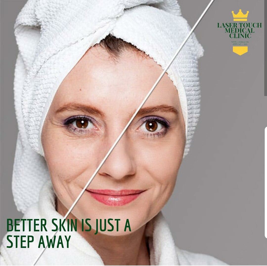 No one likes to look in the mirror and see the signs of aging. However, if this sounds like you, you have come to the right place! Laser Touch Medical Clinic offers a wide variety of ways to treat aging skin and give you a beautiful, youthful appearance. If you desire a non-surgical way to achieve great, long-lasting results, talk to Dr. Hakimian about our non-surgical procedures. For those who want a younger-looking appearance or a quick pick-me-up to help reduce the signs of aging, Laser Touch Medical Clinic offers the highest-quality and most popular non-surgical procedures, including BotoxÂ® and DysportTM. A quick injection here and there and you can be out the door in just thirty minutes with a younger-looking appearance and firmer skin.