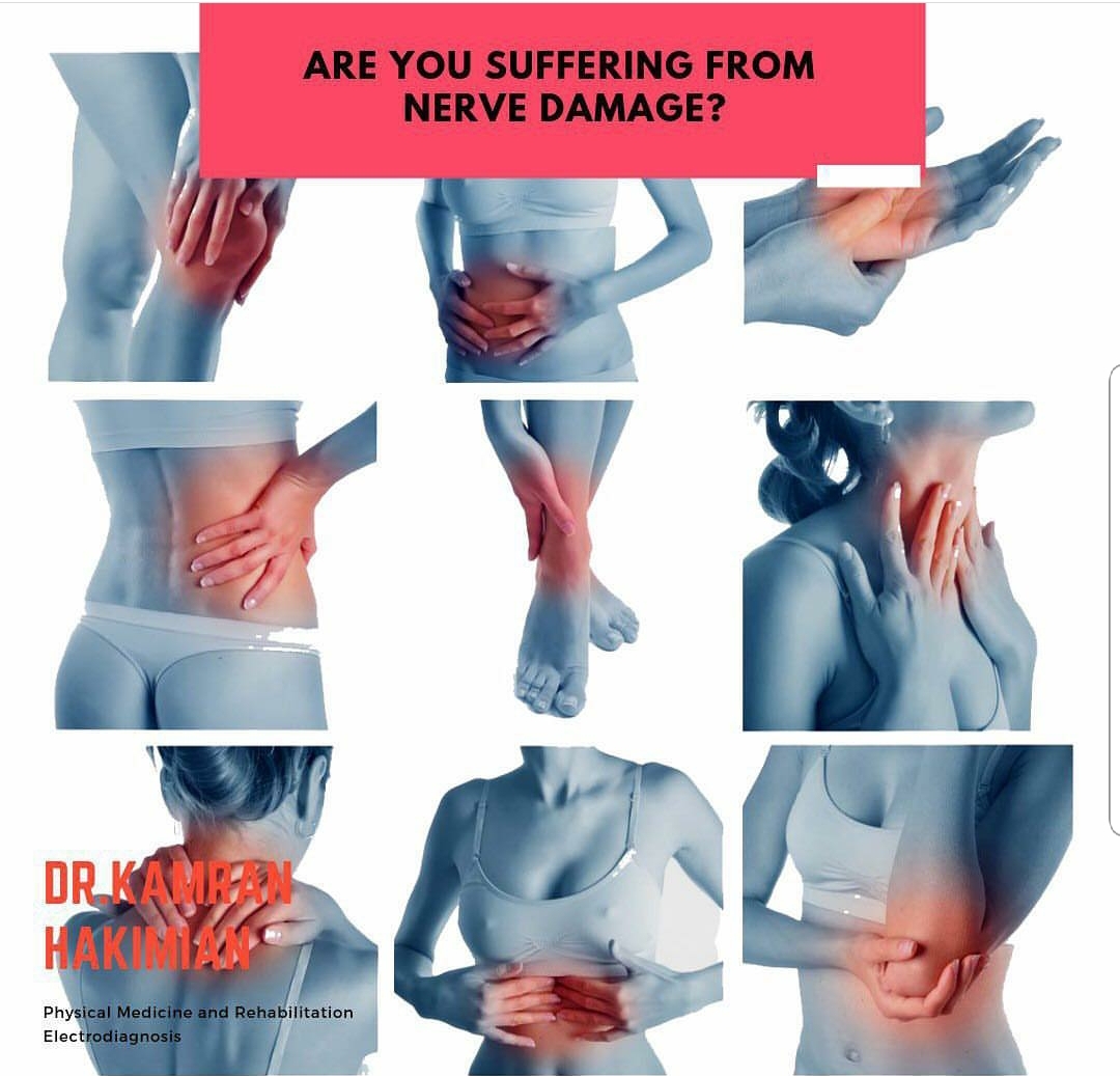 Welcome to California Sports & Rehab. If you are suffering from nerve damage, numbing, tingling or weakness sensations we are here to help. For scheduling of EMG/NCV for all locations: Central Tel: (310) 652-6060 Fax: (310) 652-6607 We accept most insurances, Private, Worker's Comp and Personal Injury.