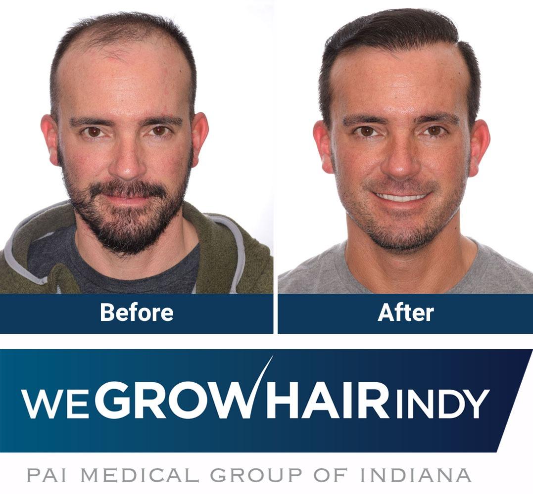 We Grow Hair Indy Photo