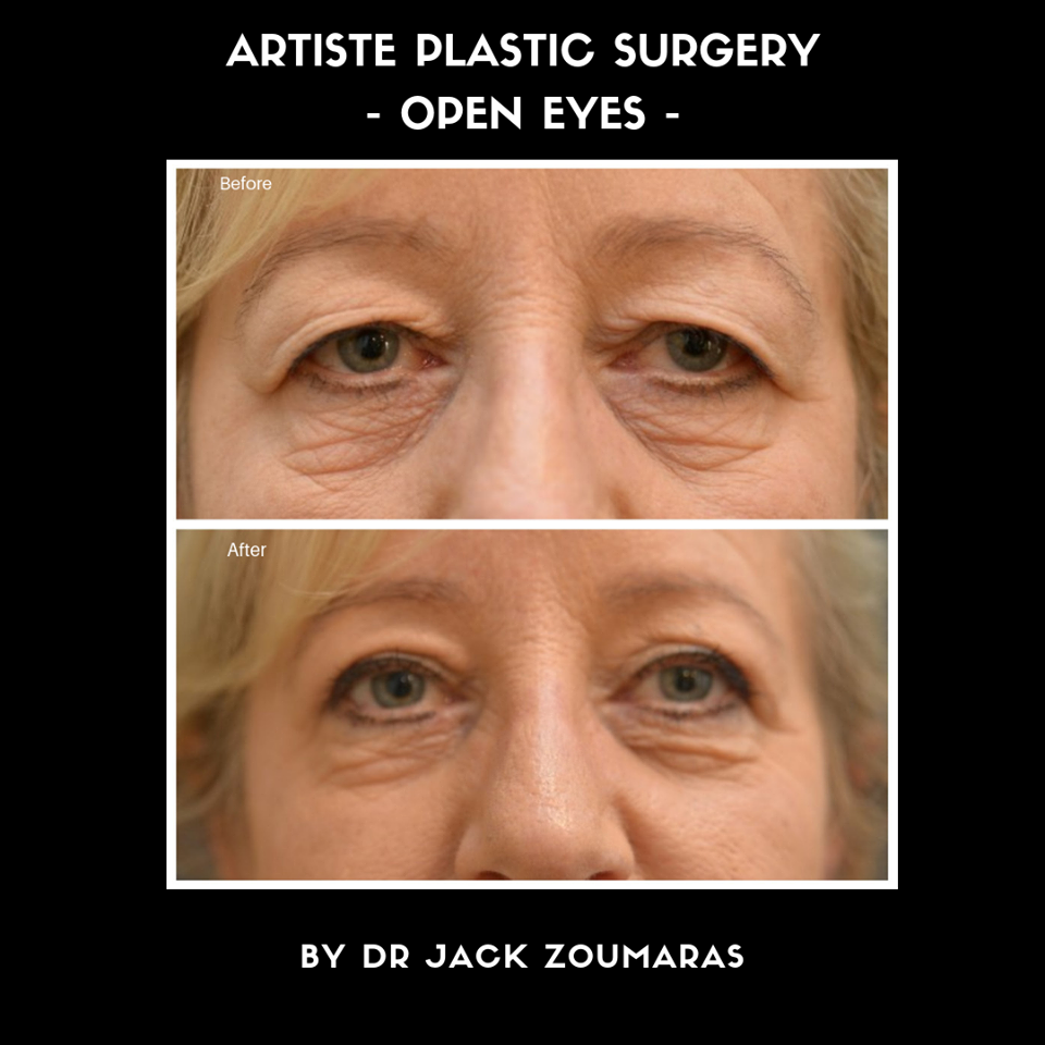 Images Artiste Plastic Surgery - Dr. Jack Zoumaras
