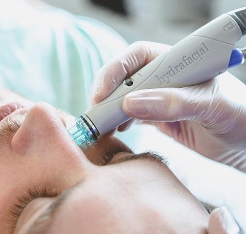 HydraFacial Bern – deep-cleansing facial