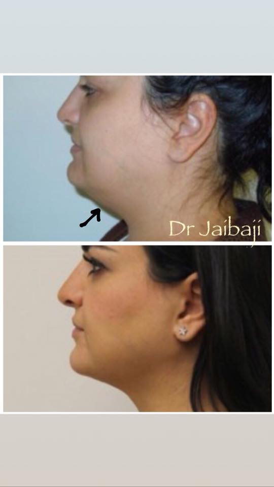 Jaibaji Plastic Surgery Photo