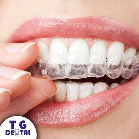 Images T.G. Dental