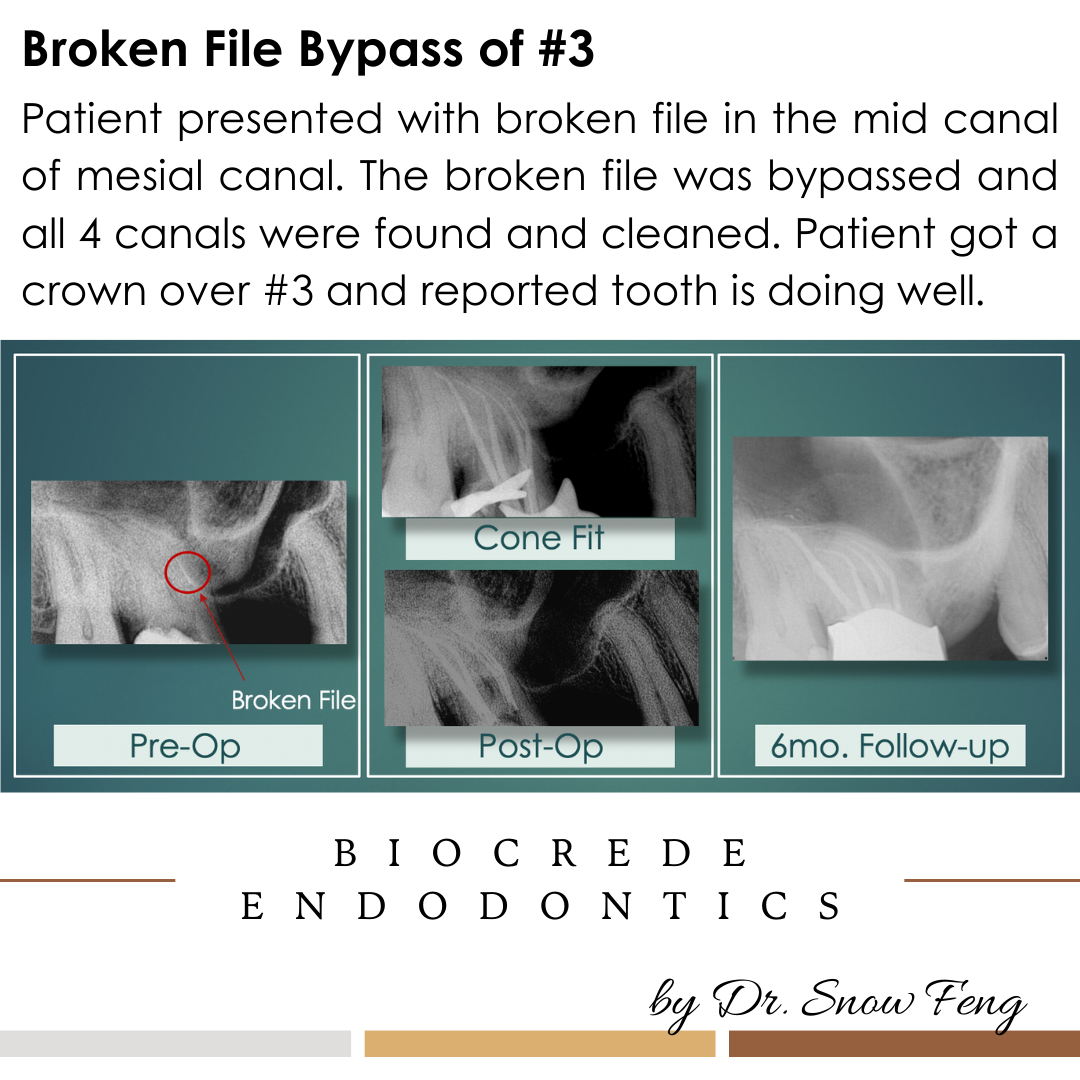 Biocrede Endodontics Image