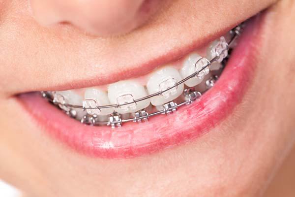 Yang Orthodontics-Langhorne Photo