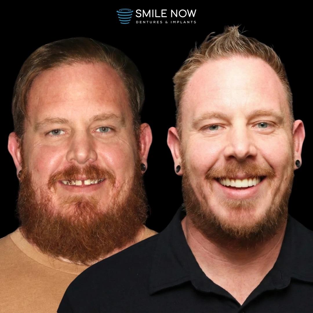 Smile Now Boise Dentures and Implants Image