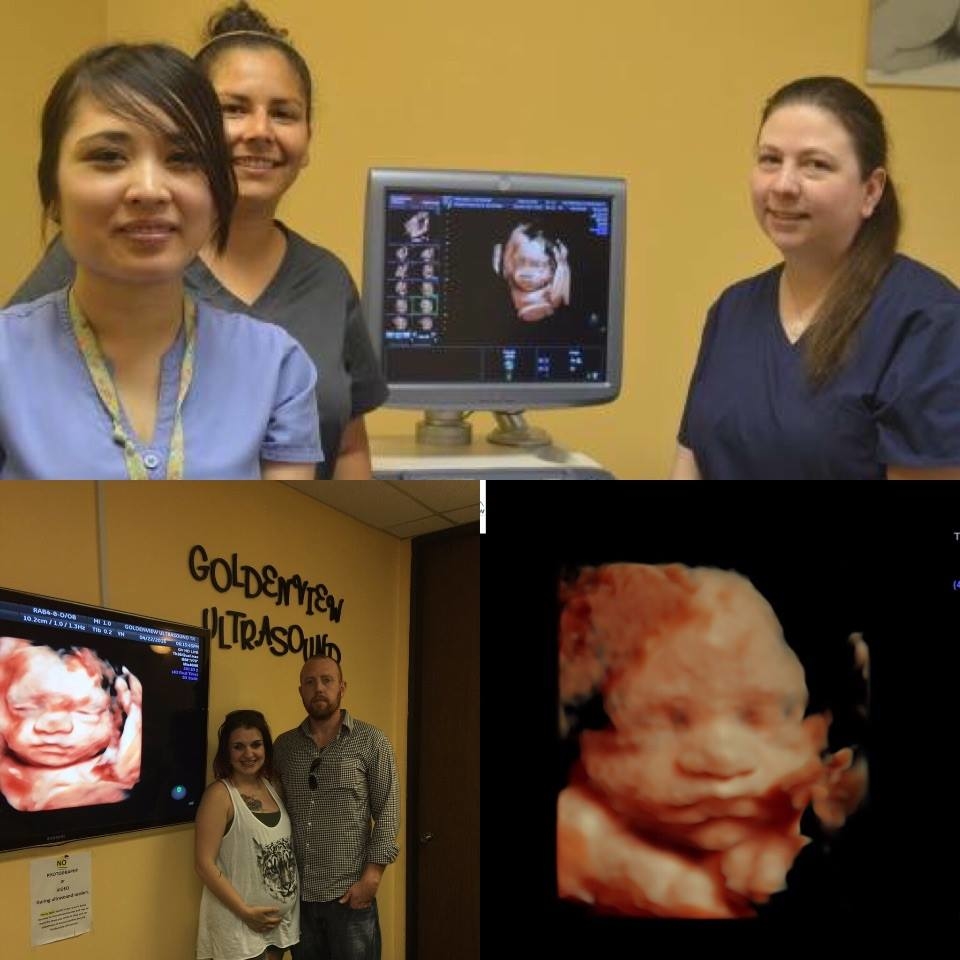 Goldenview Ultrasound 3d/4d/HDlive San Antonio Photo