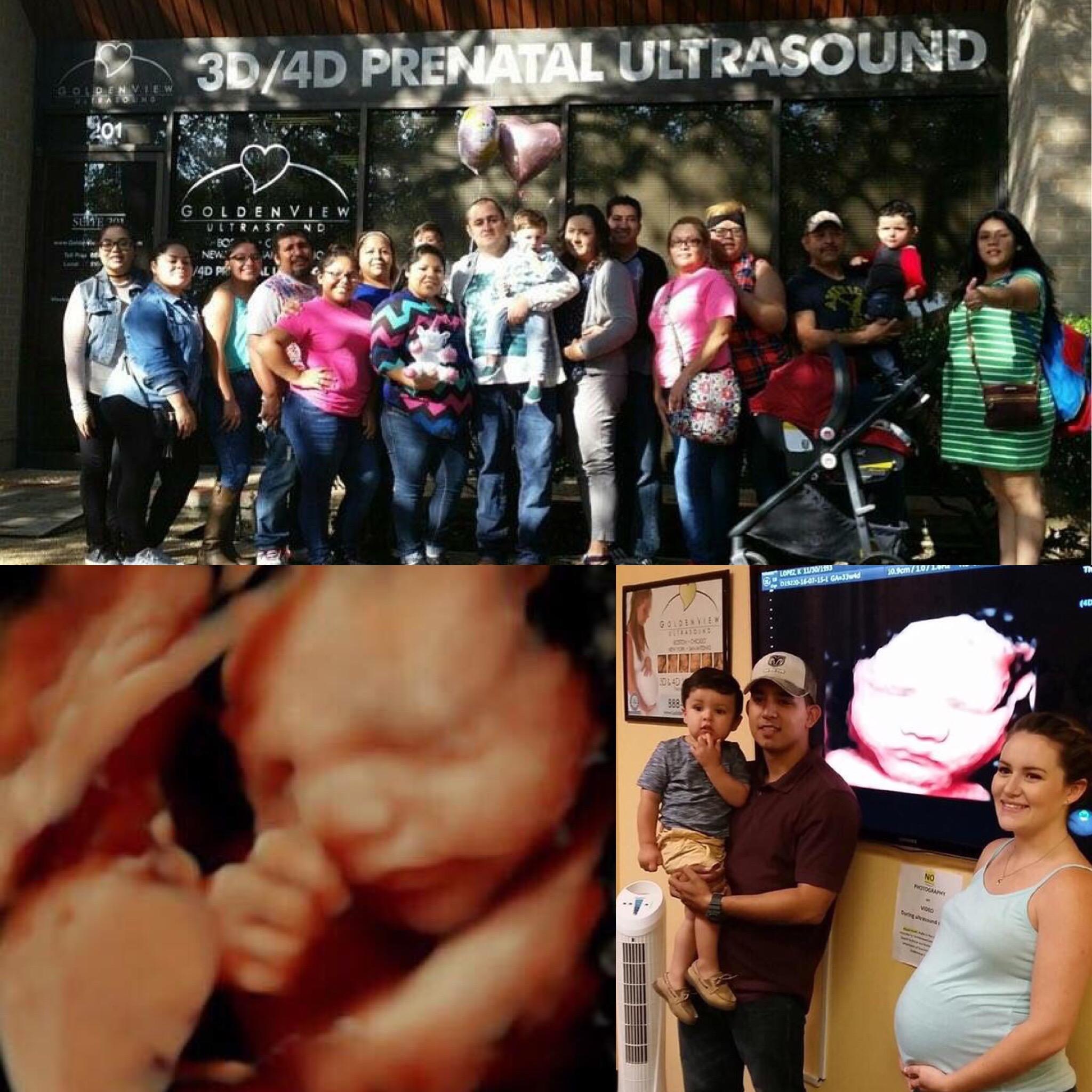 Goldenview Ultrasound 3d/4d/HDlive San Antonio Photo