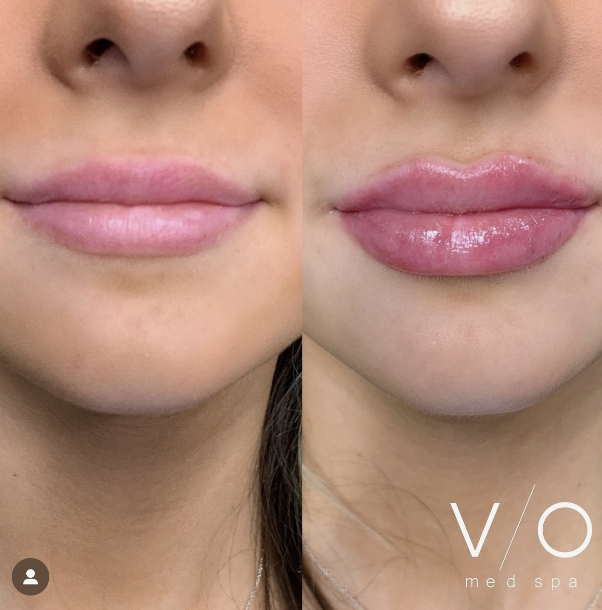VIO Med Spa | Jacksonville