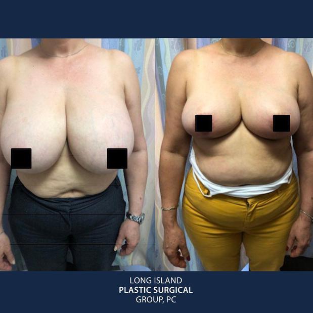Images New York Plastic Surgical Group, a Division of Long Island Plastic Surgical Group, PC