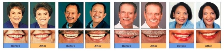 Images North Vancouver Denture Clinic