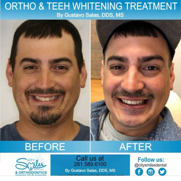 Images City Smiles Dental And Orthodontics