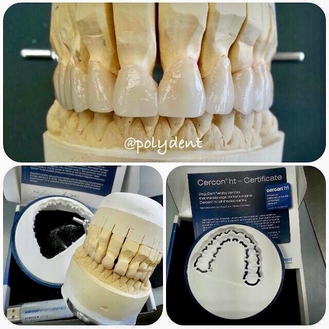 Images Poly-Dent Ceramic