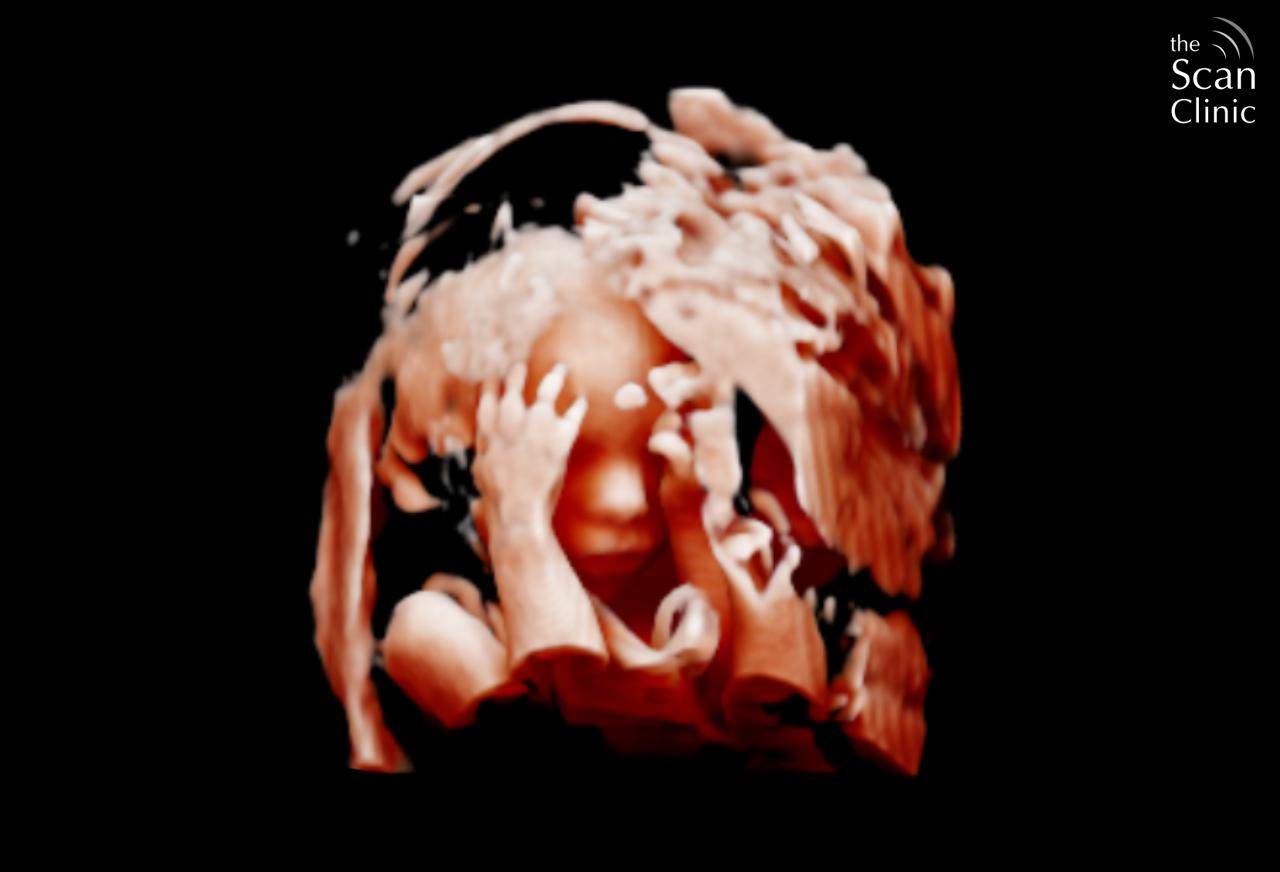 Gallery thumbnail
