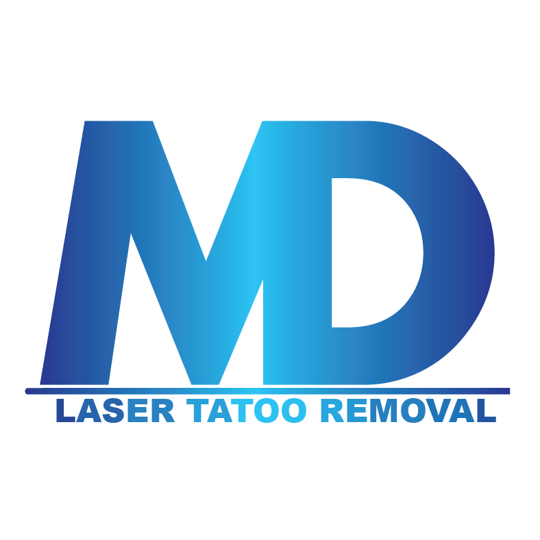 MD Laser Tattoo Removal Baltimore