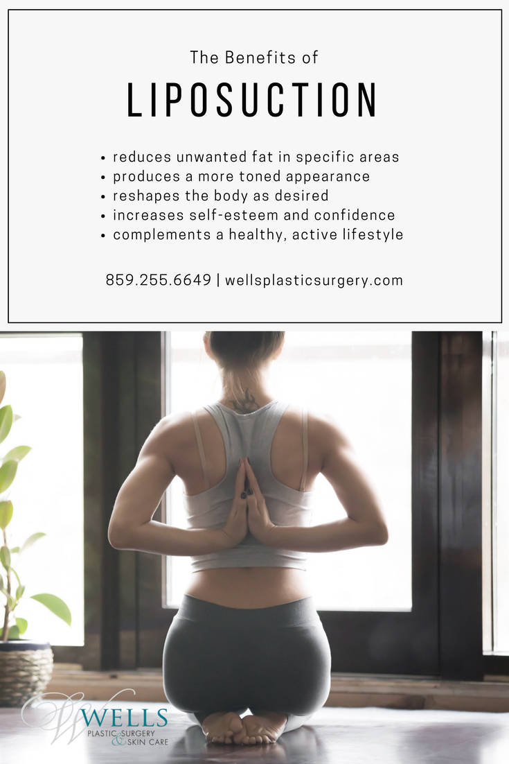 Liposuction