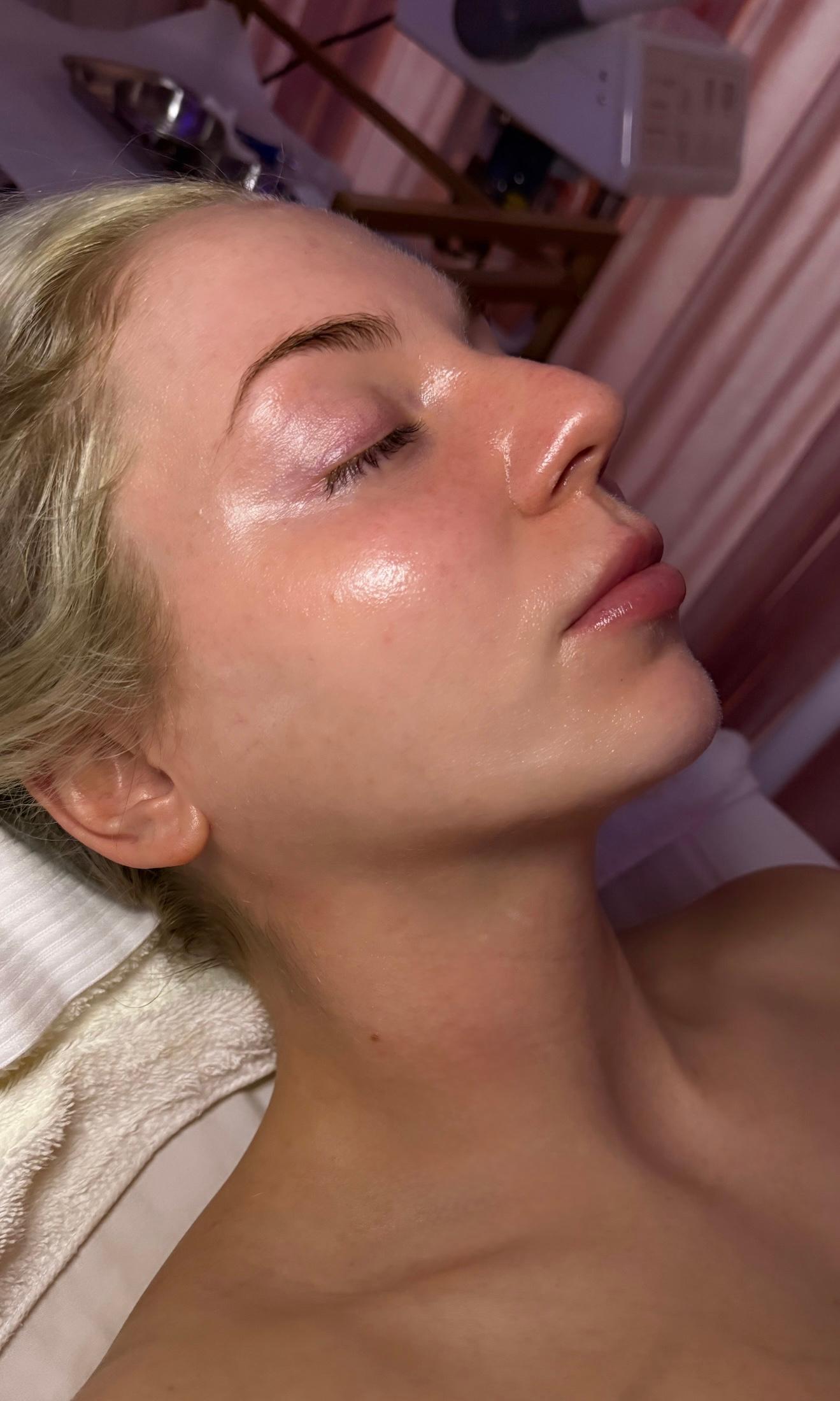 Bisous Esthetics Image