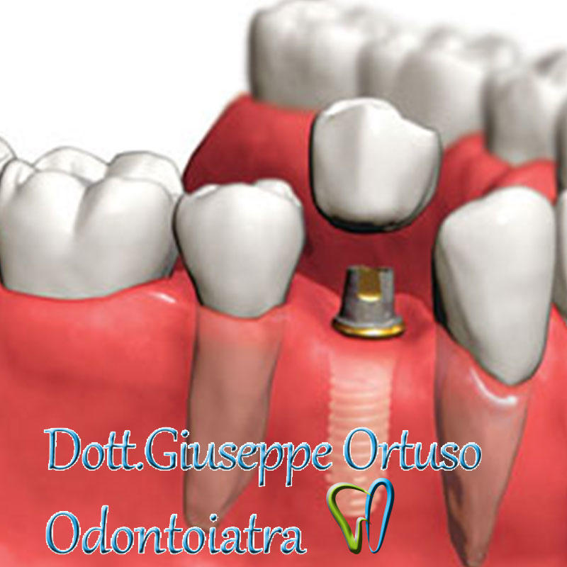 Images Studio Dentistico e Odontoiatrico Dottor Ortuso Giuseppe