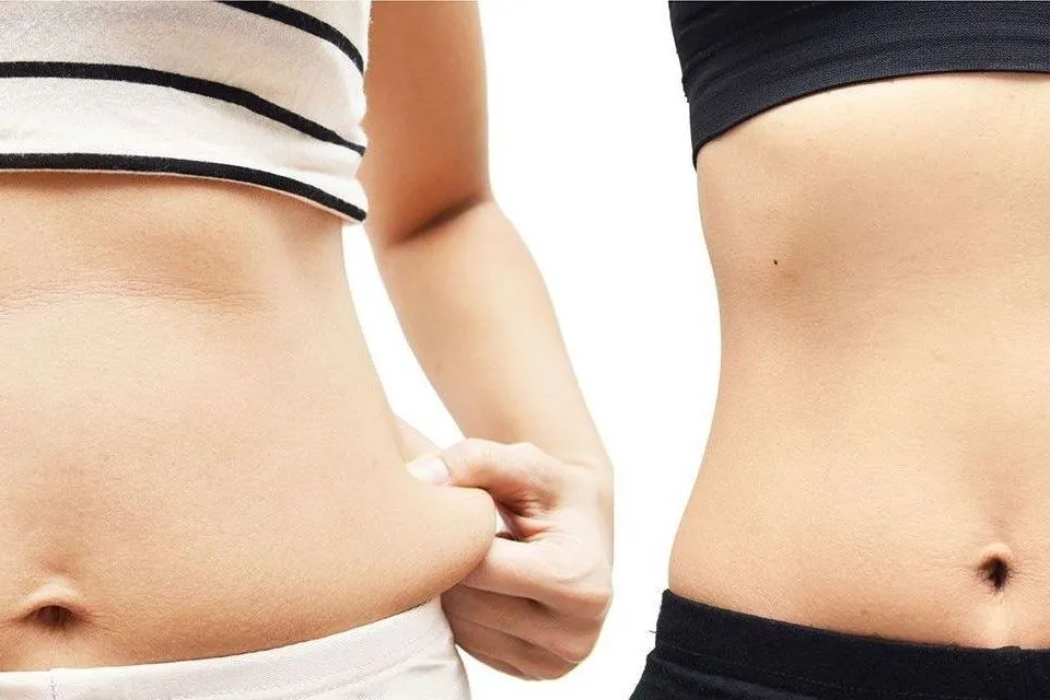 Fat Removal