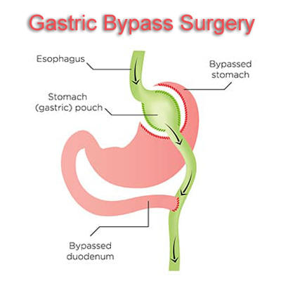 Advanced Bariatrics Photo