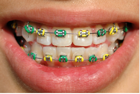 Amazing Smiles Orthodontics Photo