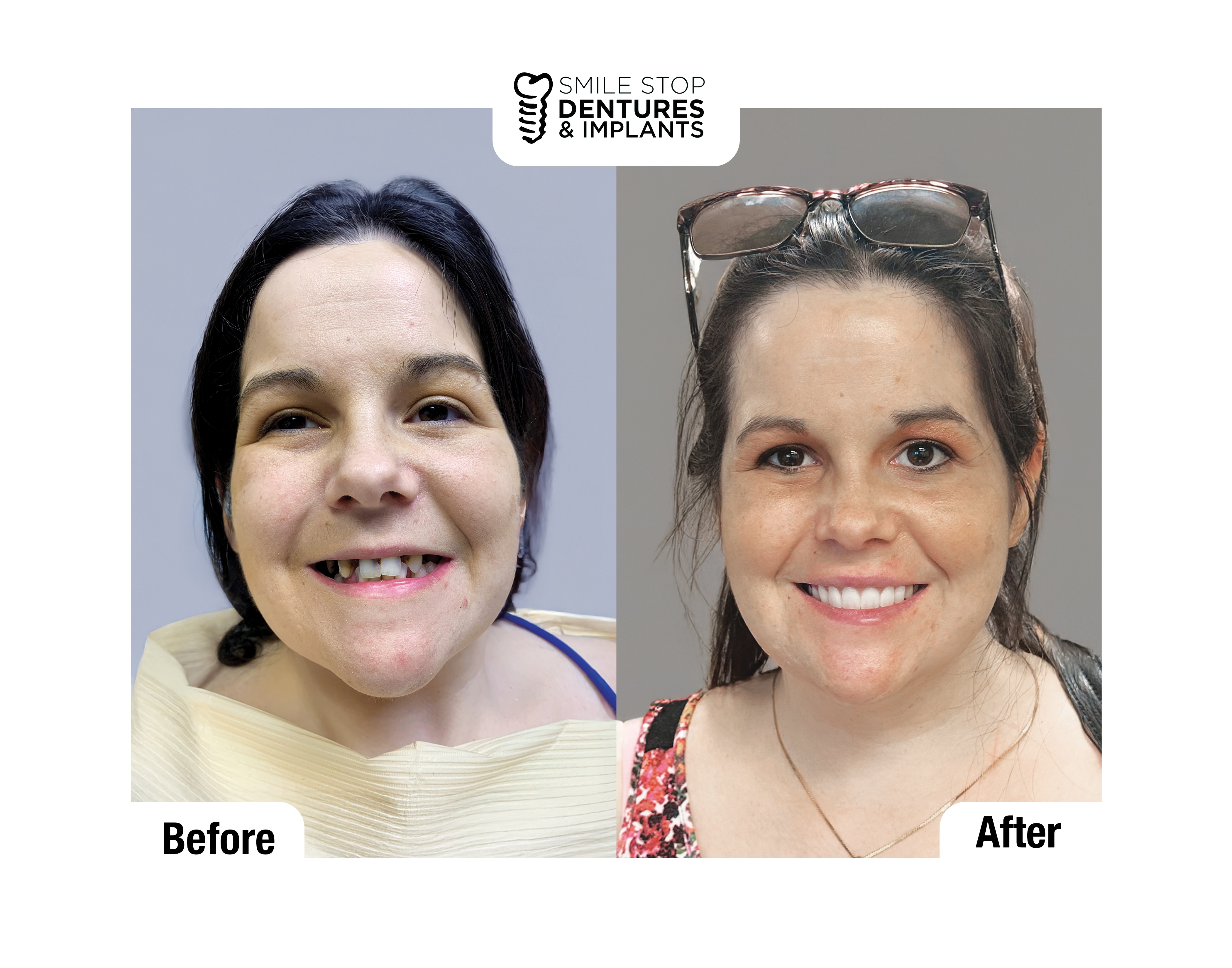 Smile Stop Dentures & Implants Image