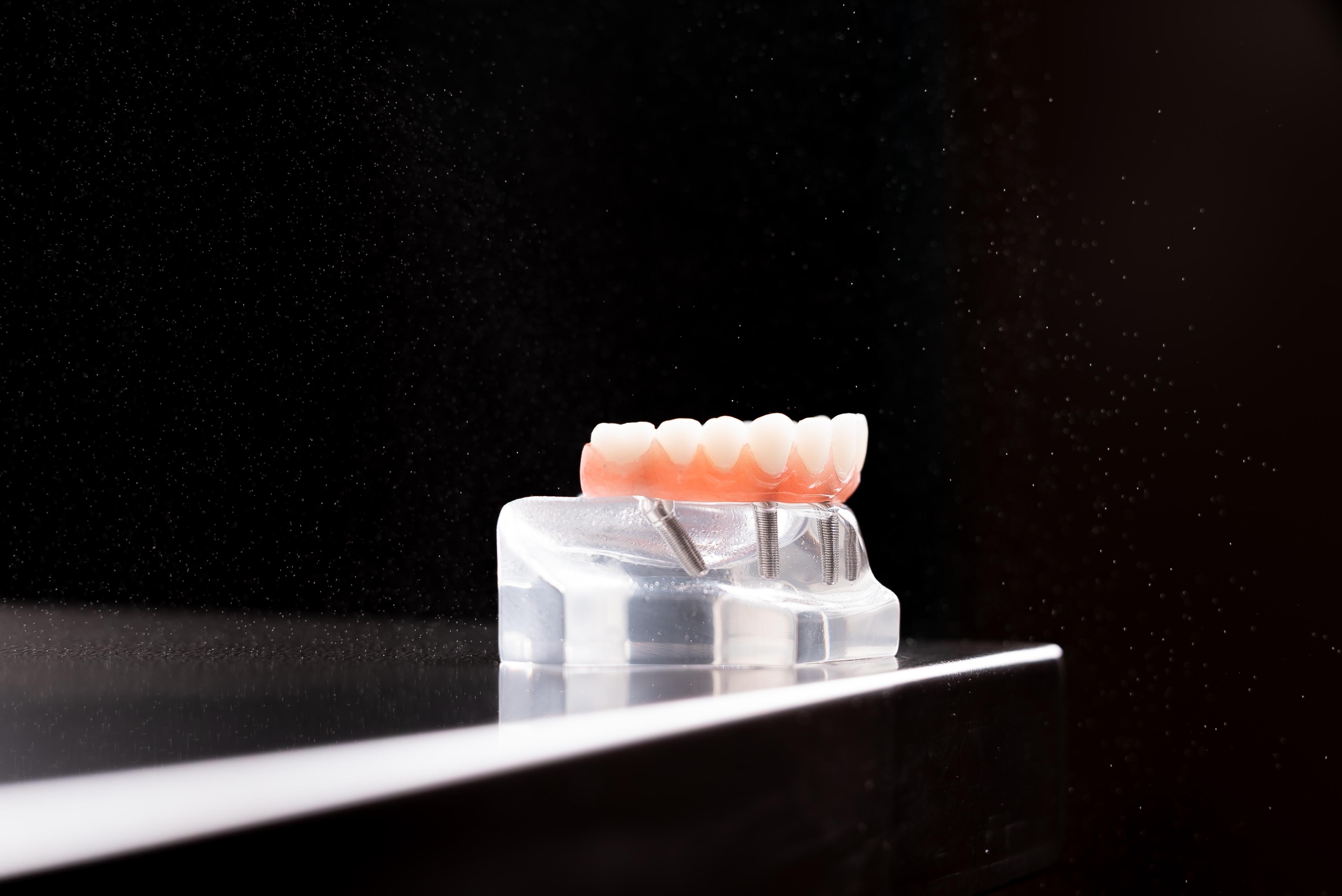 Advanced Dental Implants & Oral Surgery - Bonney Lake