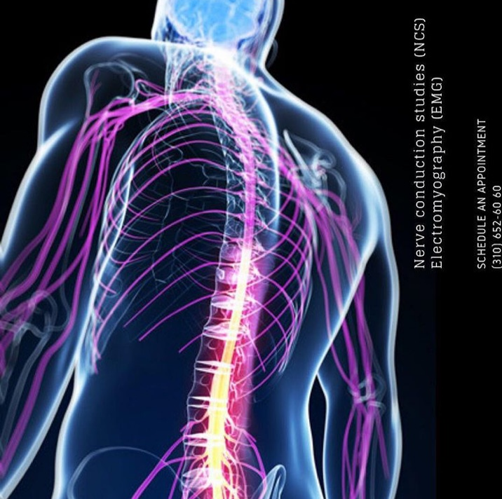 At California Sports & Rehab, we use a test known as EMG (Electromyography) to help determine any nerve damage you are experiencing. This could include: carpal tunnel syndrome, cubital tunnel syndrome, diabetic neuropathy, herniated disk disease, sciatic nerve problems, pinched nerves and peripheral nerve injury. Come in to visit us today!