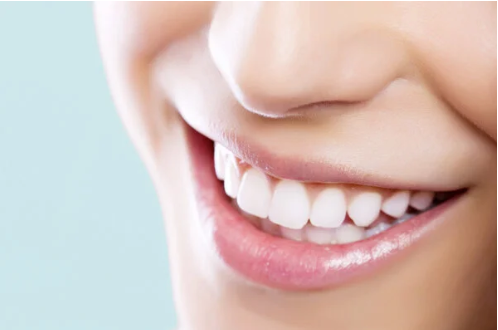 Correzioni dentali estetiche / Veneers