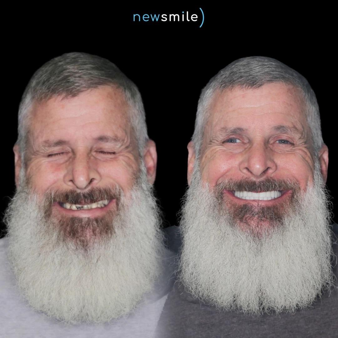 New Smile Columbus Dental Implant Studio Image