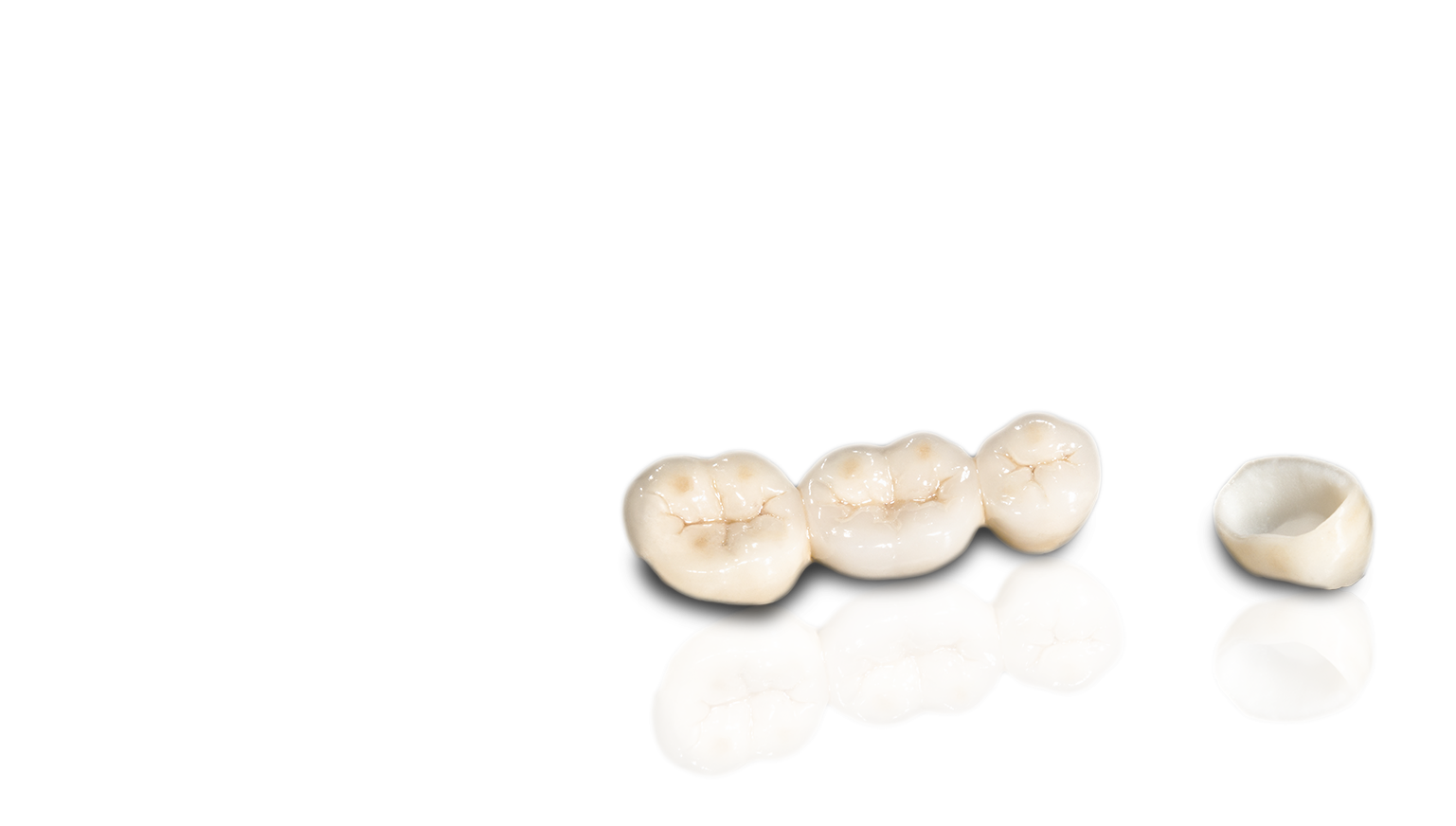 All-Ceramic Restorations