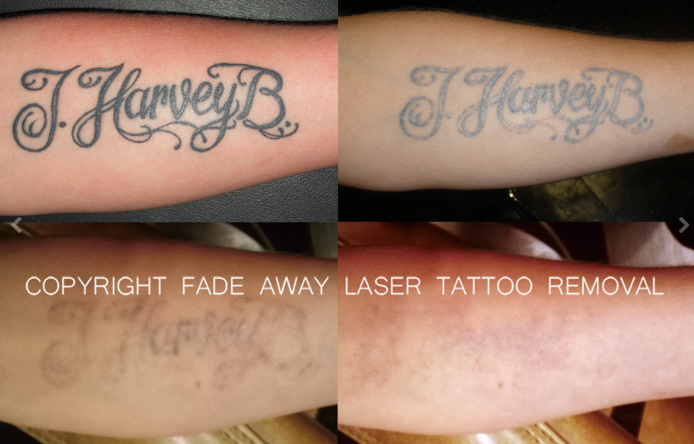 Benchmark Tattoo &amp; Fade Away Laser Tattoo Removal at 1831 ...