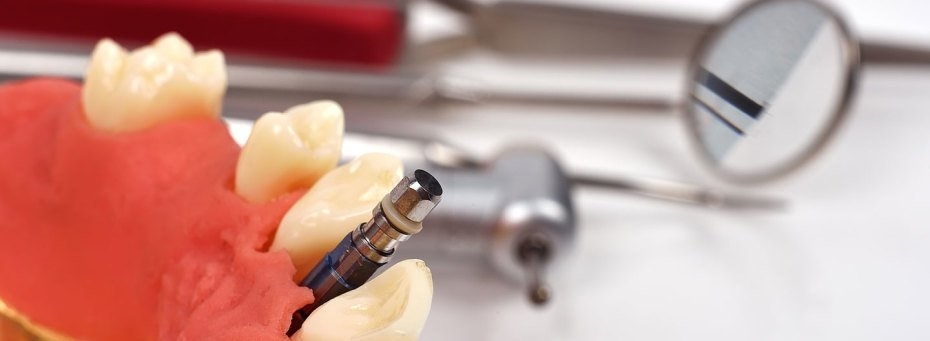 Images North Vancouver Denture Clinic