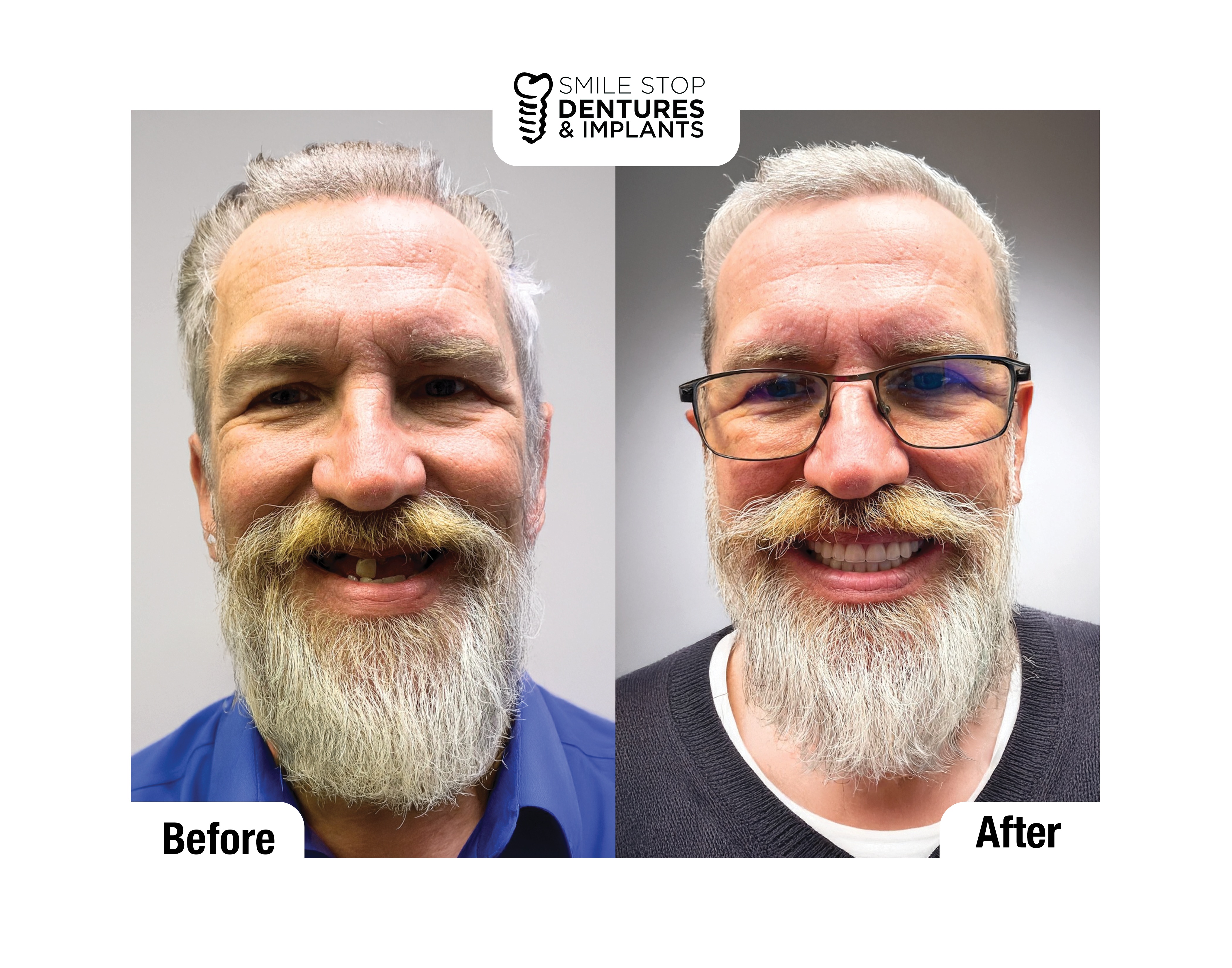 Smile Stop Dentures & Implants Image